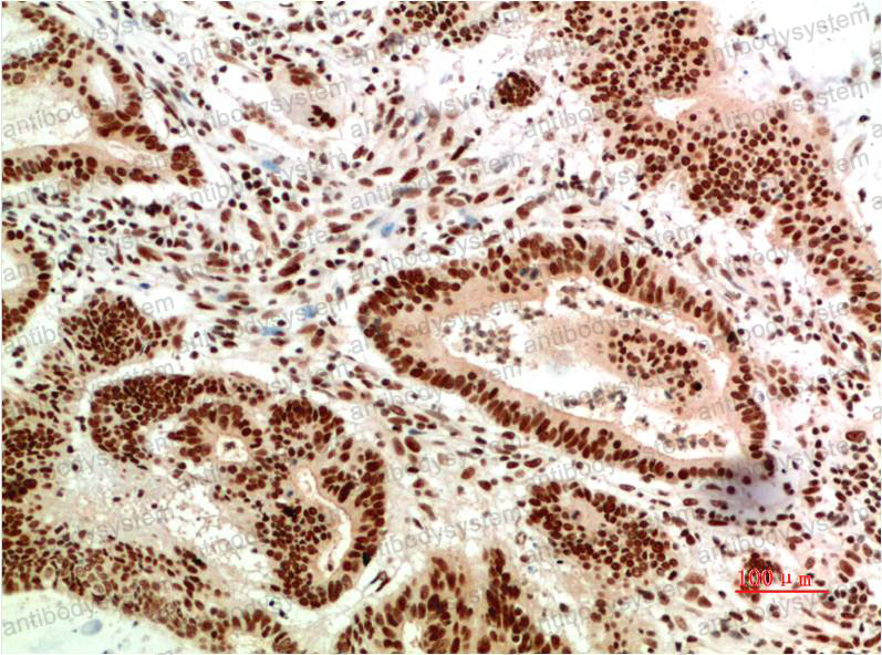 Валидация AntibodySystem RHG48105 (2969)