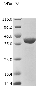 SDS-PAGE