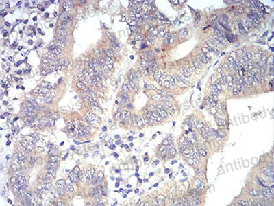 Валидация AntibodySystem RHD32604