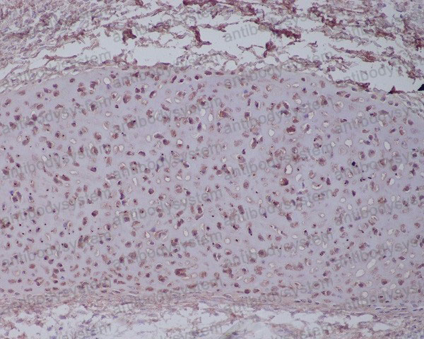 Валидация AntibodySystem RHD15201