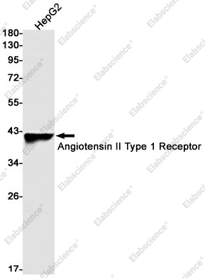 Вестерн-блоттинг, Angiotensin II Type 1 Receptor, клетки HepG2