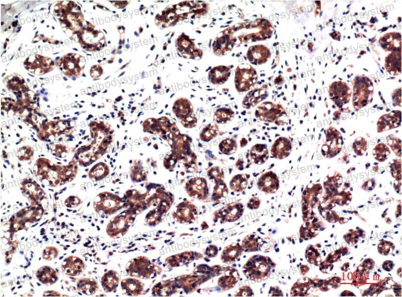 Валидация AntibodySystem RHD73610