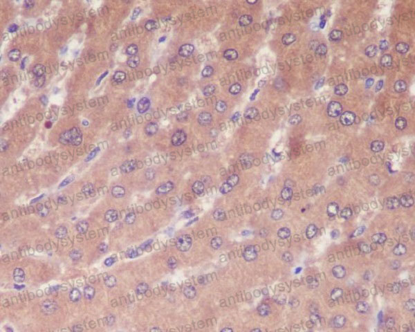 Валидация AntibodySystem RHD84101