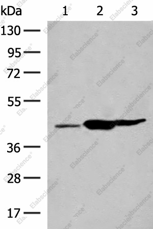 Вестерн-блоттинг, GPR22, ткани печени мыши, почки мыши и мозга крысы