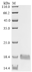 SDS-PAGE