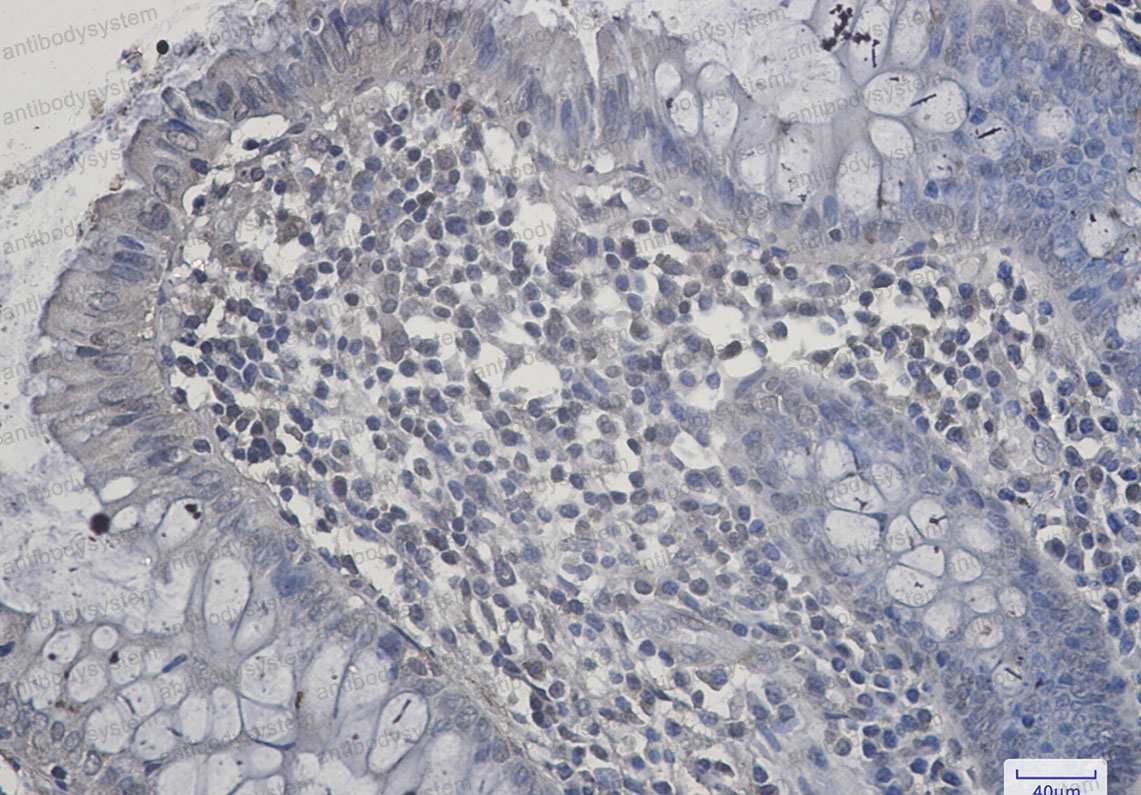 Валидация AntibodySystem RHJ19601