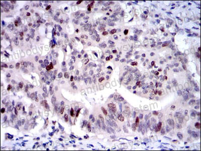 Валидация AntibodySystem RHG90703