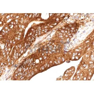 Валидация Affinity AF5181 - 2610