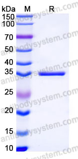 YHD01901, SDS-PAGE