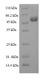 SDS-PAGE
