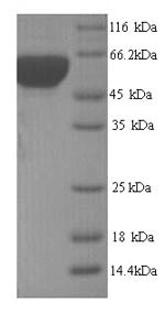 SDS-PAGE
