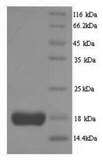 SDS-PAGE