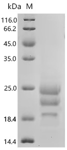 SDS-PAGE