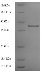 SDS-PAGE