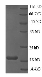 SDS-PAGE