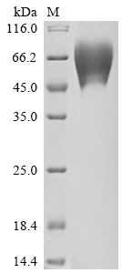 SDS-PAGE