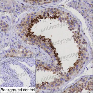 Валидация AntibodySystem RHD89301