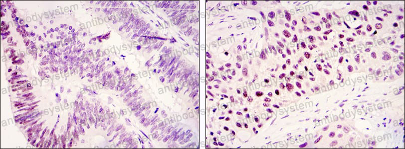 Валидация AntibodySystem RHK37801