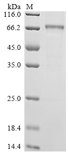 SDS-PAGE
