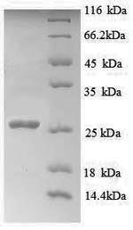 SDS-PAGE