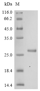 SDS-PAGE
