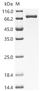 SDS-PAGE