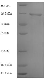 SDS-PAGE