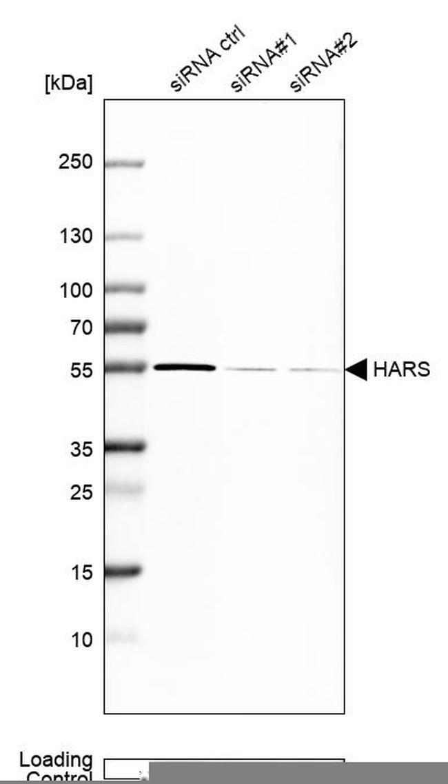 Валидация AssayVector ARM1298(787)