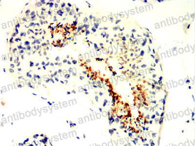 Валидация AntibodySystem RHN99302 (4046)