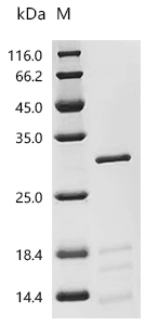 SDS-PAGE