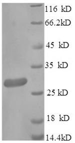 SDS-PAGE
