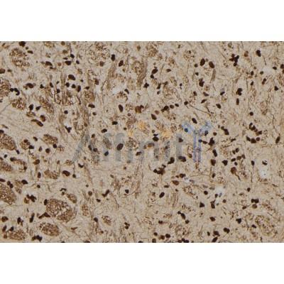 Валидация Affinity DF7335 - 19039