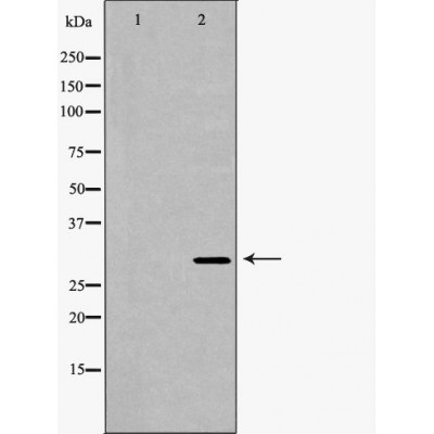 Валидация Affinity DF6976 - 18602