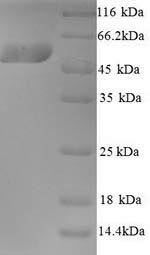 SDS-PAGE