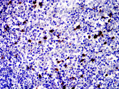 Валидация AntibodySystem RHF34004