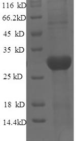 SDS-PAGE