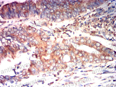 Валидация AntibodySystem RHC24104