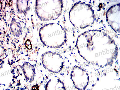 Валидация AntibodySystem RHD26504 (1440)