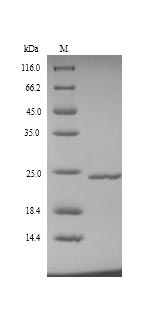 SDS-PAGE