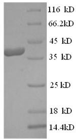 SDS-PAGE