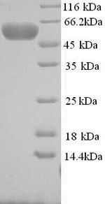 SDS-PAGE