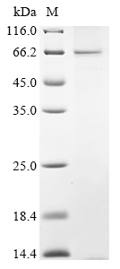 SDS-PAGE