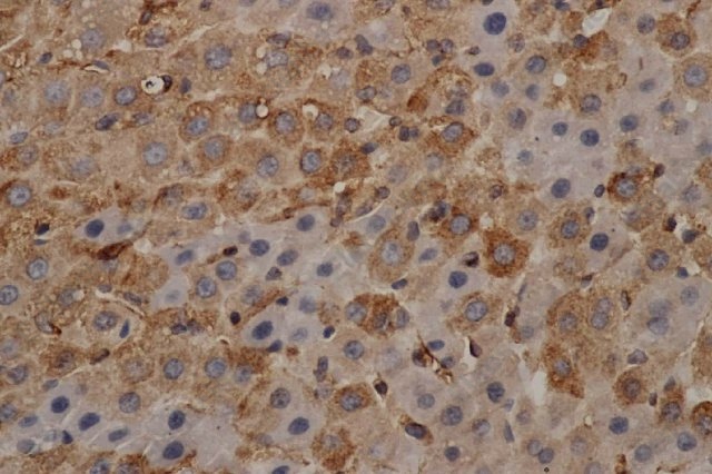 Иммуногистохимия, alpha Tubulin, ткань печени мыши