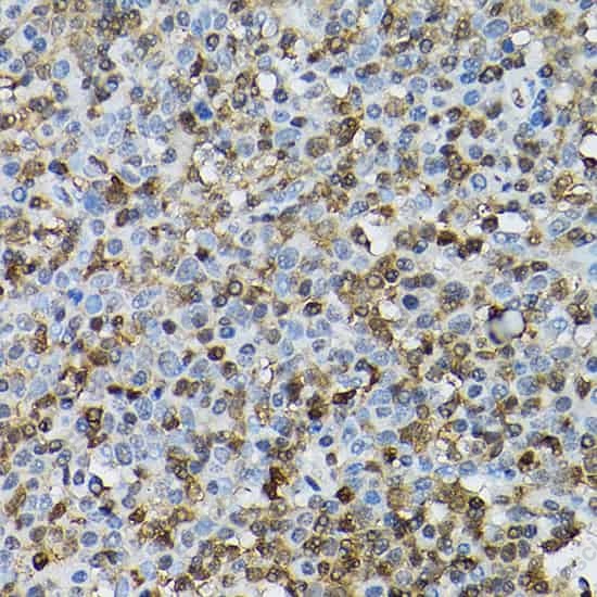 Иммуногистохимия, STAT5B, ткань миндалин человека