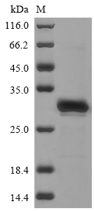 SDS-PAGE
