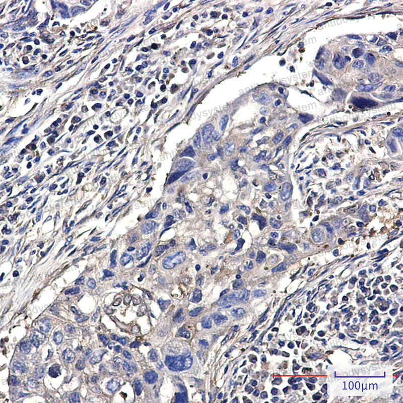 Валидация AntibodySystem RHF38801