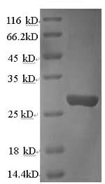 SDS-PAGE