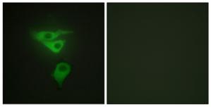 Валидация AssayVector ARM1839(2417)