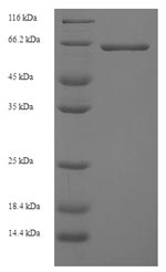 SDS-PAGE