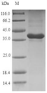 SDS-PAGE